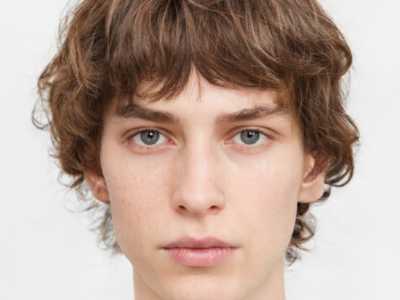 哪个医生激光脉冲治疗胎记得好国内：激光脉冲治疗胎记医生前50都在哪